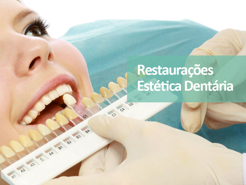 Restaurações e facetas