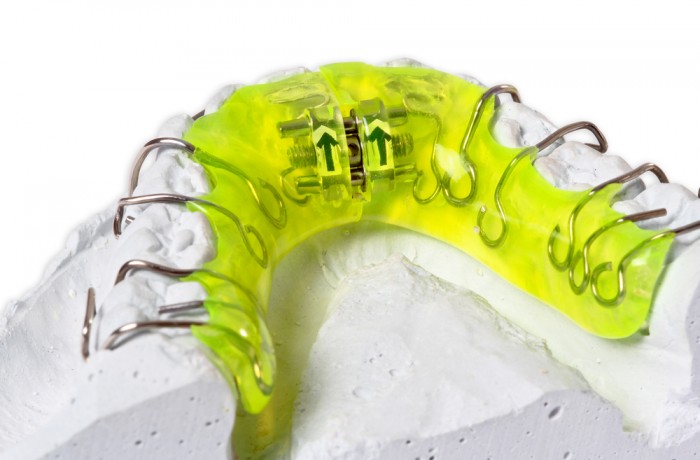 INSTRUÇÕES POST APARELHO EXPANSÃO MAXILAR