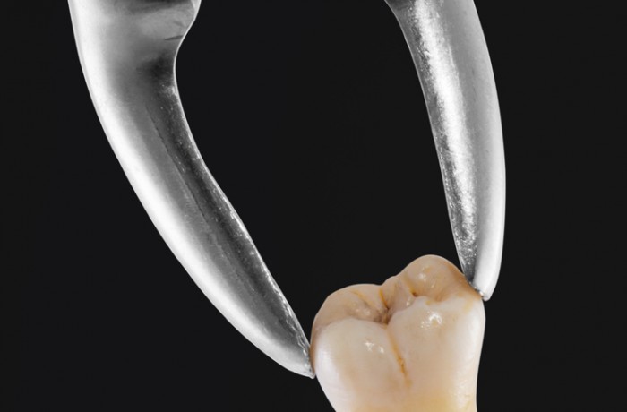 Instruções Post Extracção Dentária