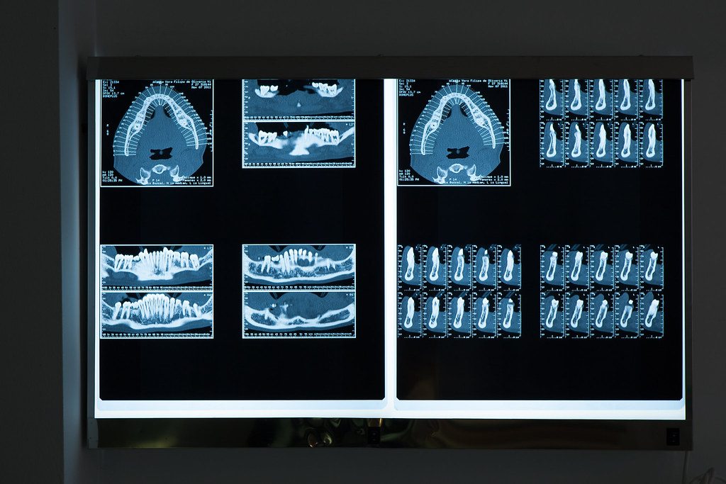 Radiografias dentárias utilizadas para diagnóstico clínico
