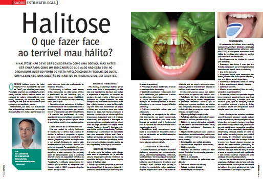 Artigo informativo sobre halitose e saúde oral