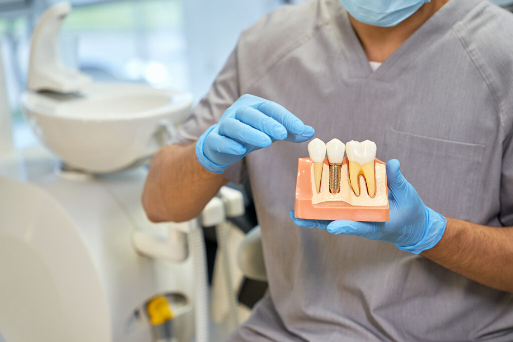 implantes dentarios estoril implantes dentarios estoril